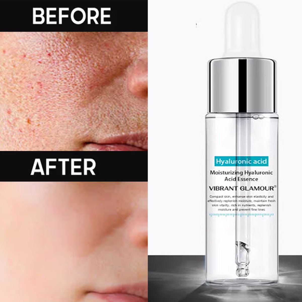 GENERICO - Serum Facial Ácido Hialurónico Blanqueamiento Antiarrugas 2 und