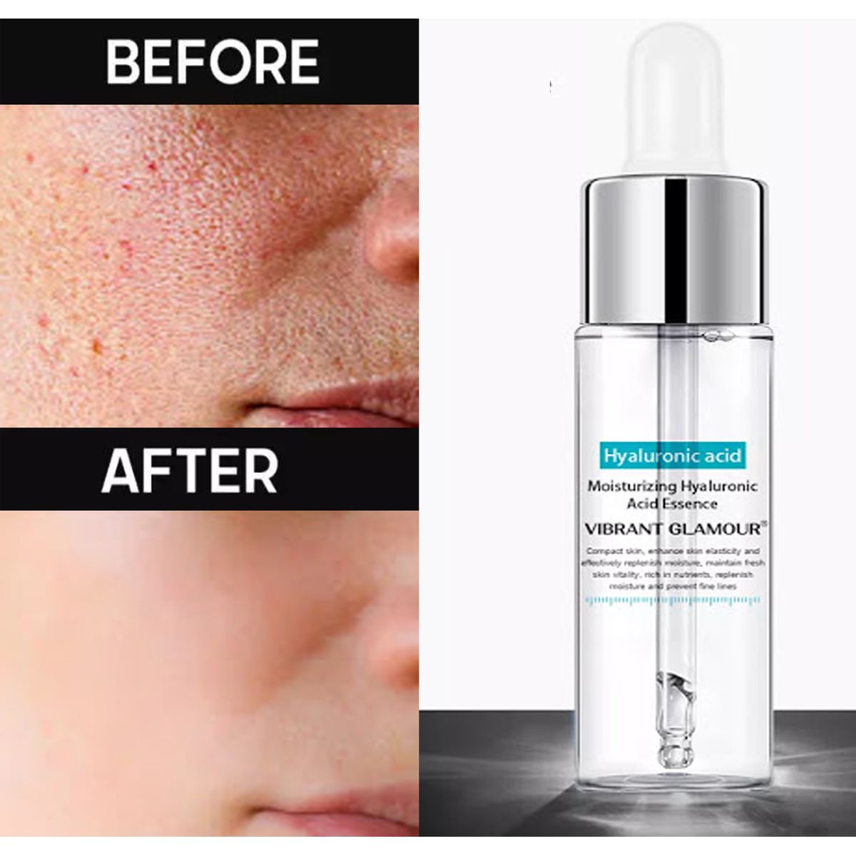 GENERICO - Serum Facial Ácido Hialurónico Blanqueamiento Antiarrugas 2 und