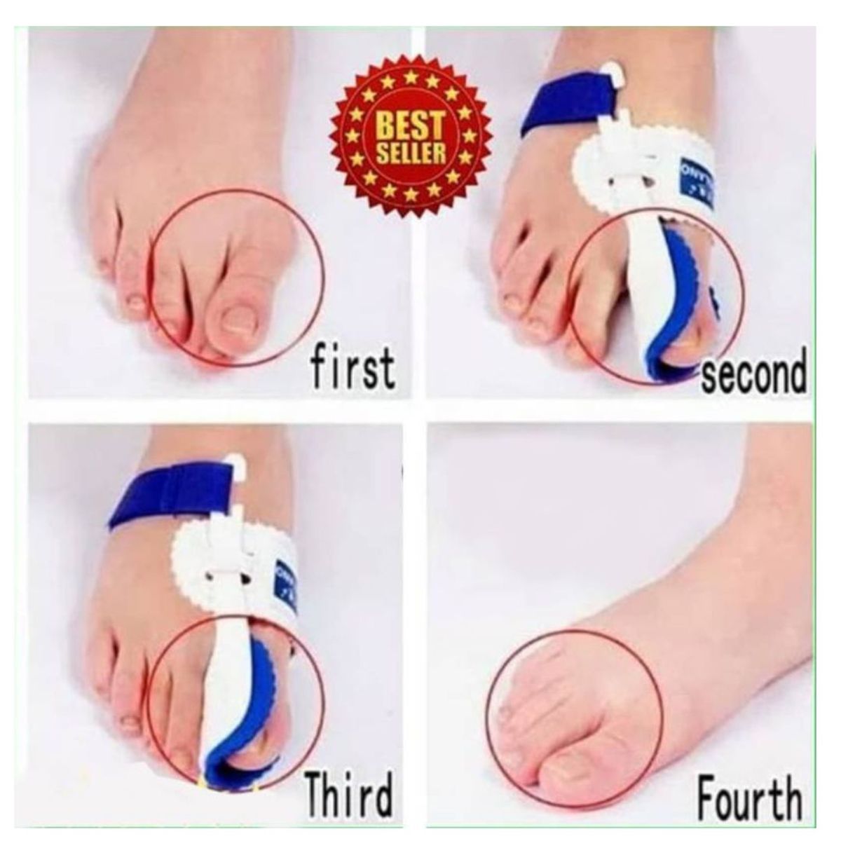 GENERICO - Férula para Juanete Corrector Alivia Dolor x 2 uni