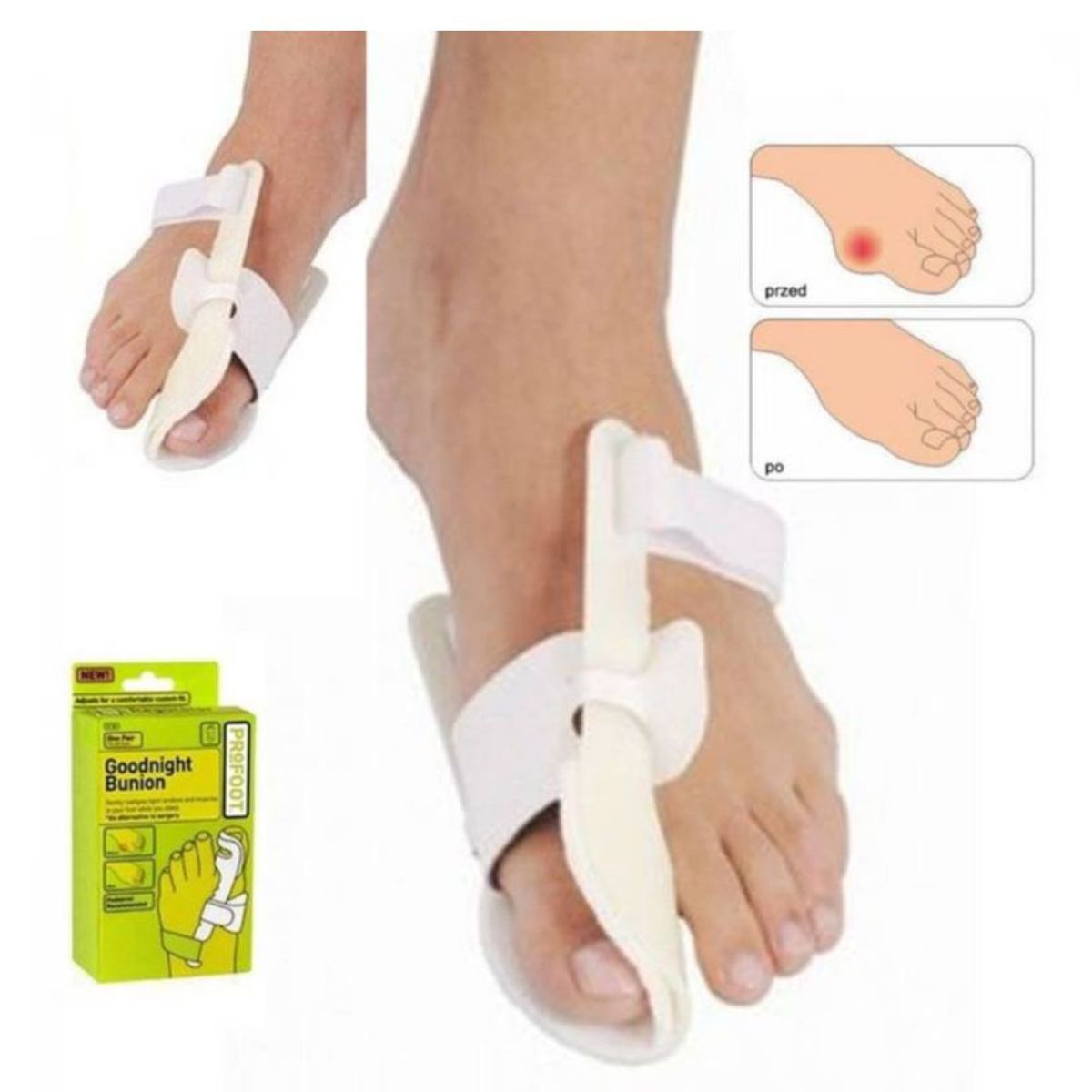 GENERICO - Kit Corrector de Juanete Estabilizador de Pie y Faja para juanete_.