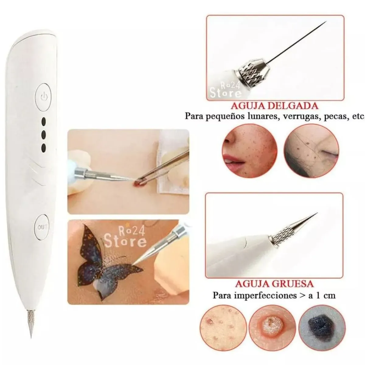 GENERICO - Maquina removedor de Verrugas vph acrocordones