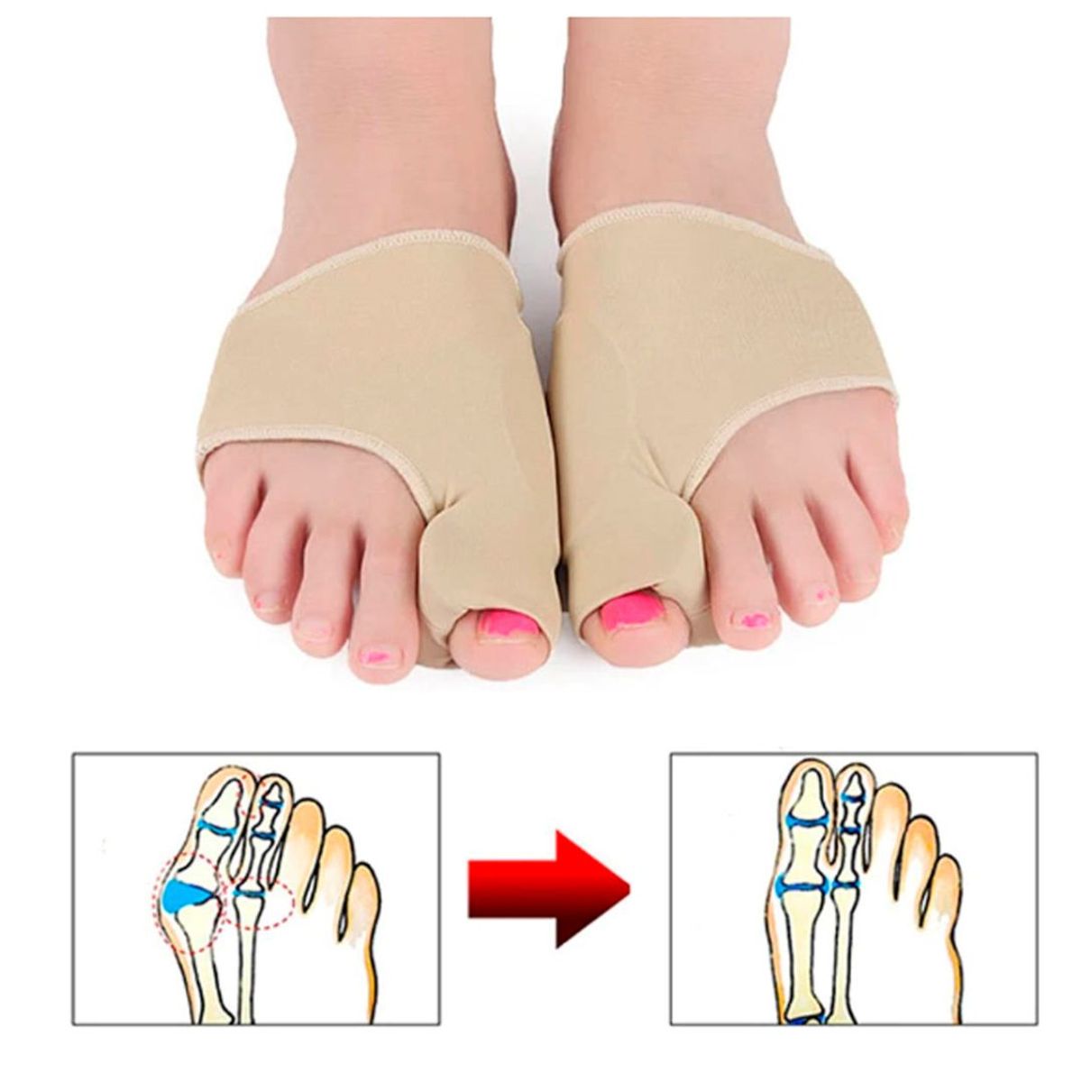 GENERICO - Calcetín de Compresión Alivia Dolor Pie Corrector de Juanete