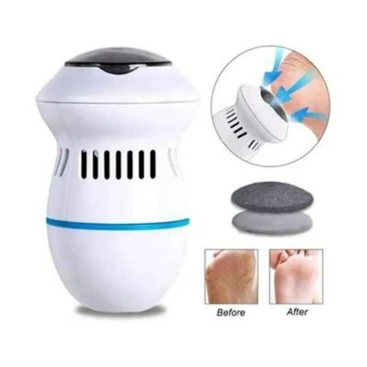 GENERICO - Removedor de Callos Cuidado de Pies recargable