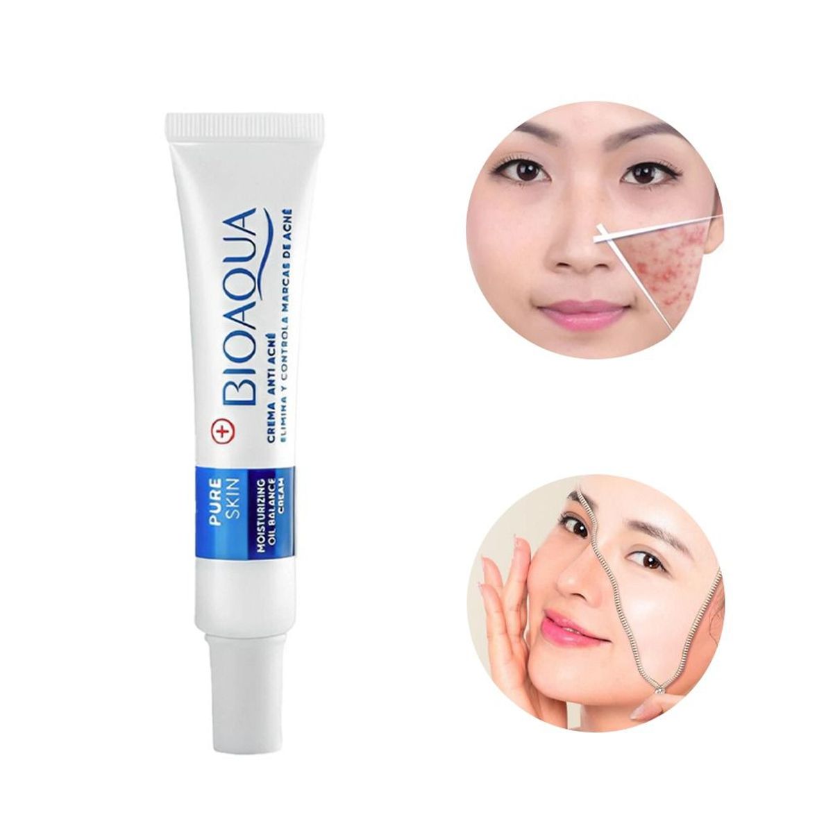 BIOAQUA - Crema Pure Skin Anti-Acné Bioaqua + Jabón DermoAcne Carbón Activo