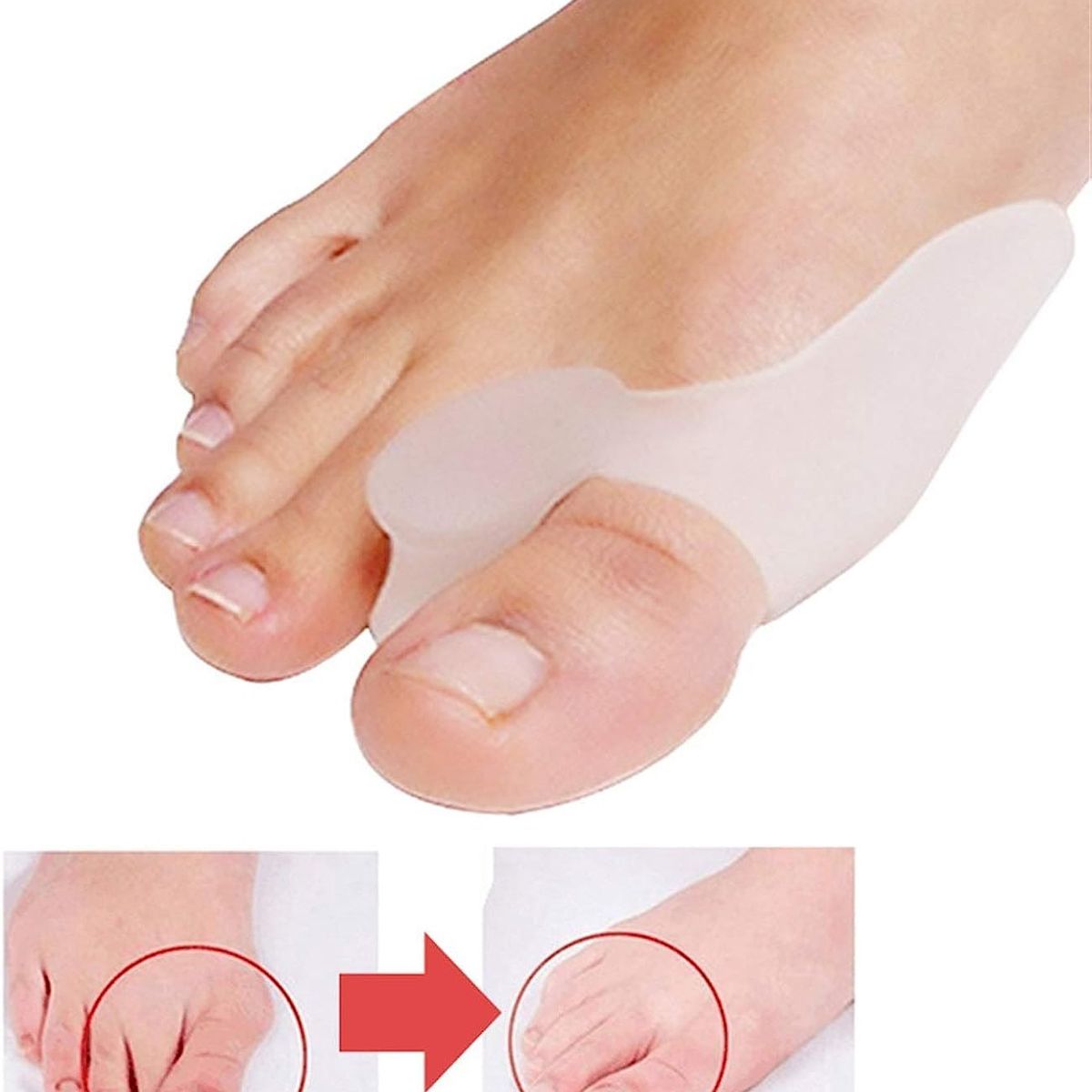 SILIFORM - Protector de Juanete Duo con separador taba