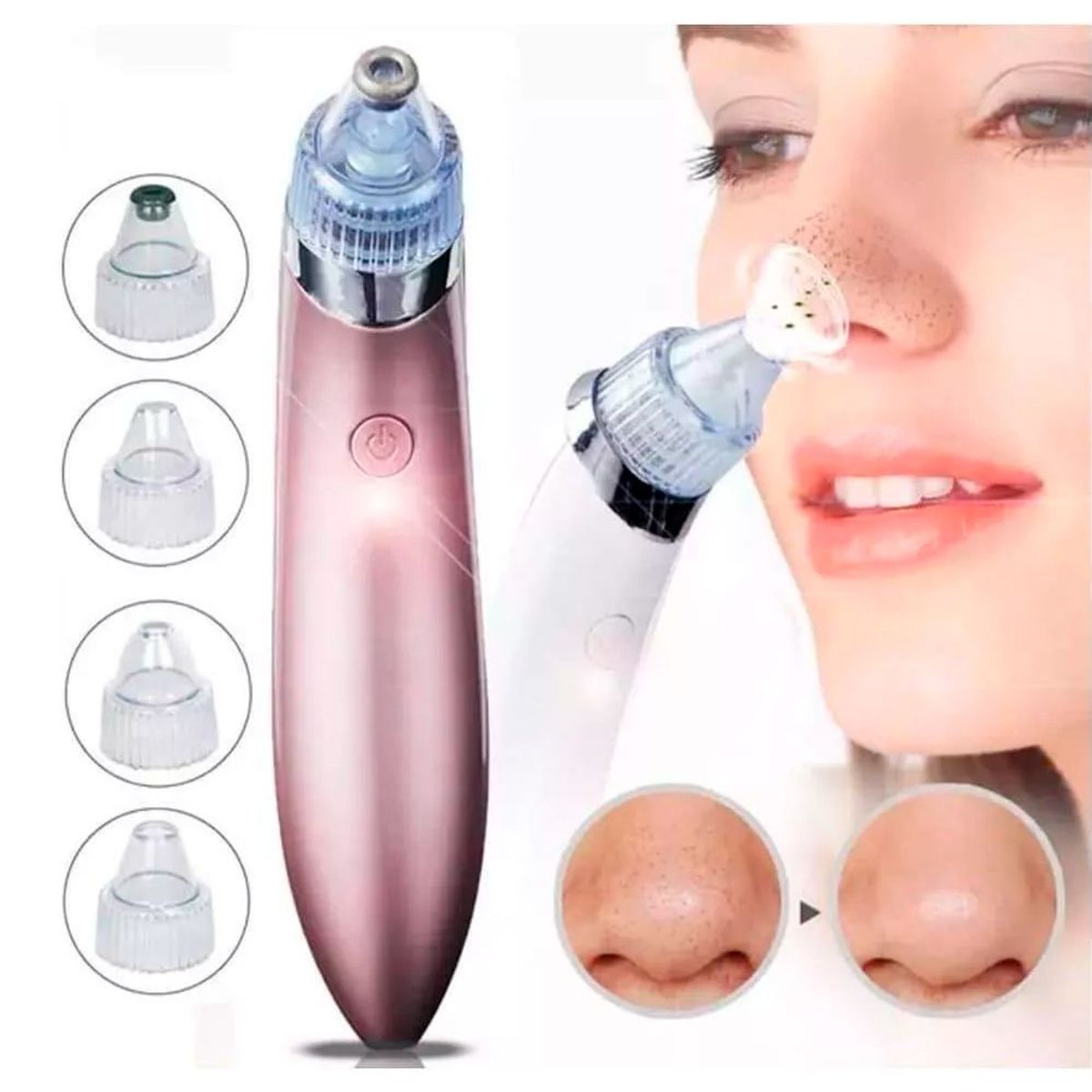 GENERICO - Limpiador Facial Succionador Puntos Negro Aspirador De Acné