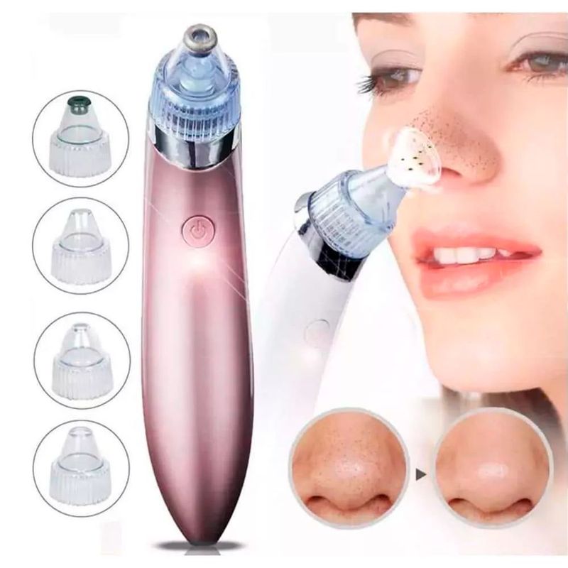 GENERICO - Limpiador Facial Succionador Puntos Negro Aspirador De Acné