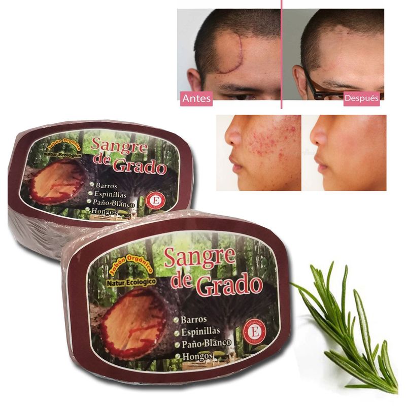 GENERICO - Jabón De Sangre Grado antiacné 2 UND
