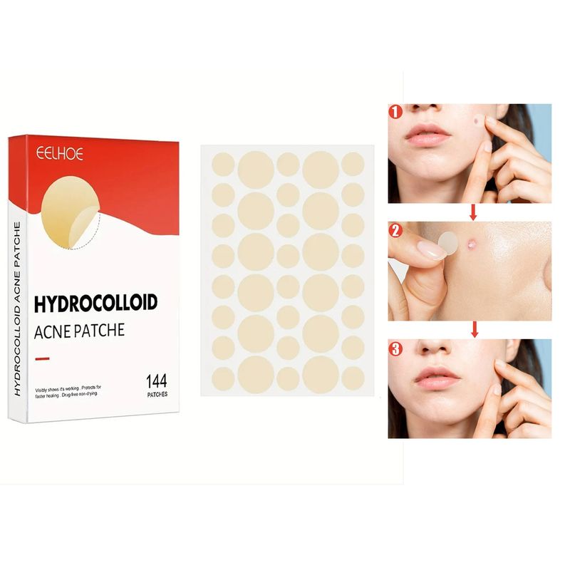 GENERICO - Parches tratamiento de Acné  SET de 144 und