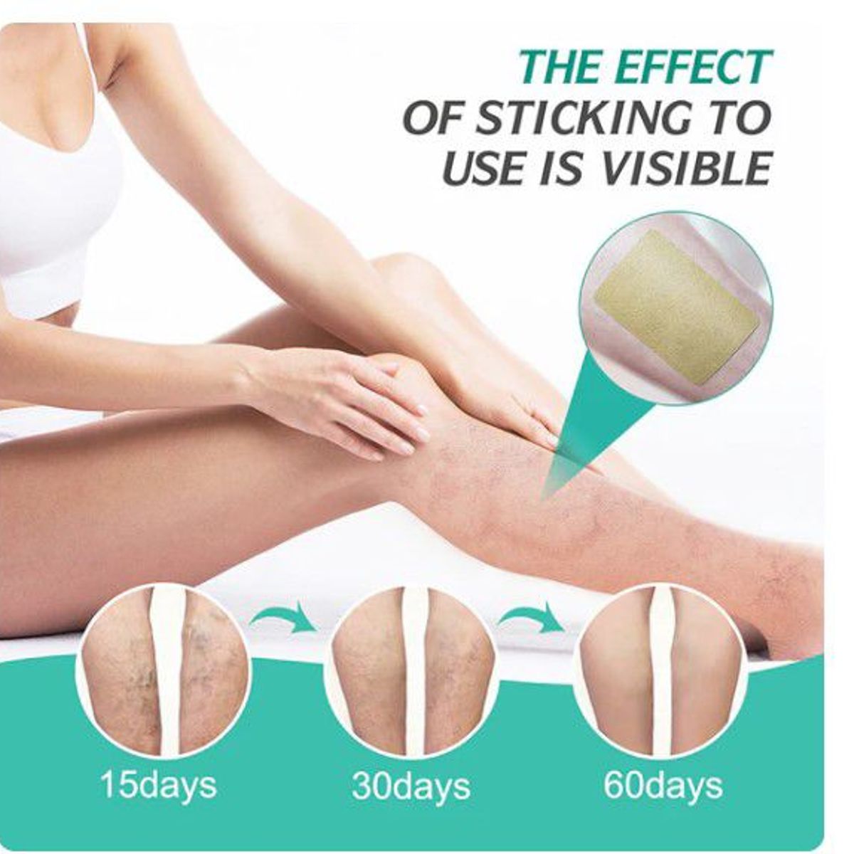 GENERICO - parche de tratamiento de varices