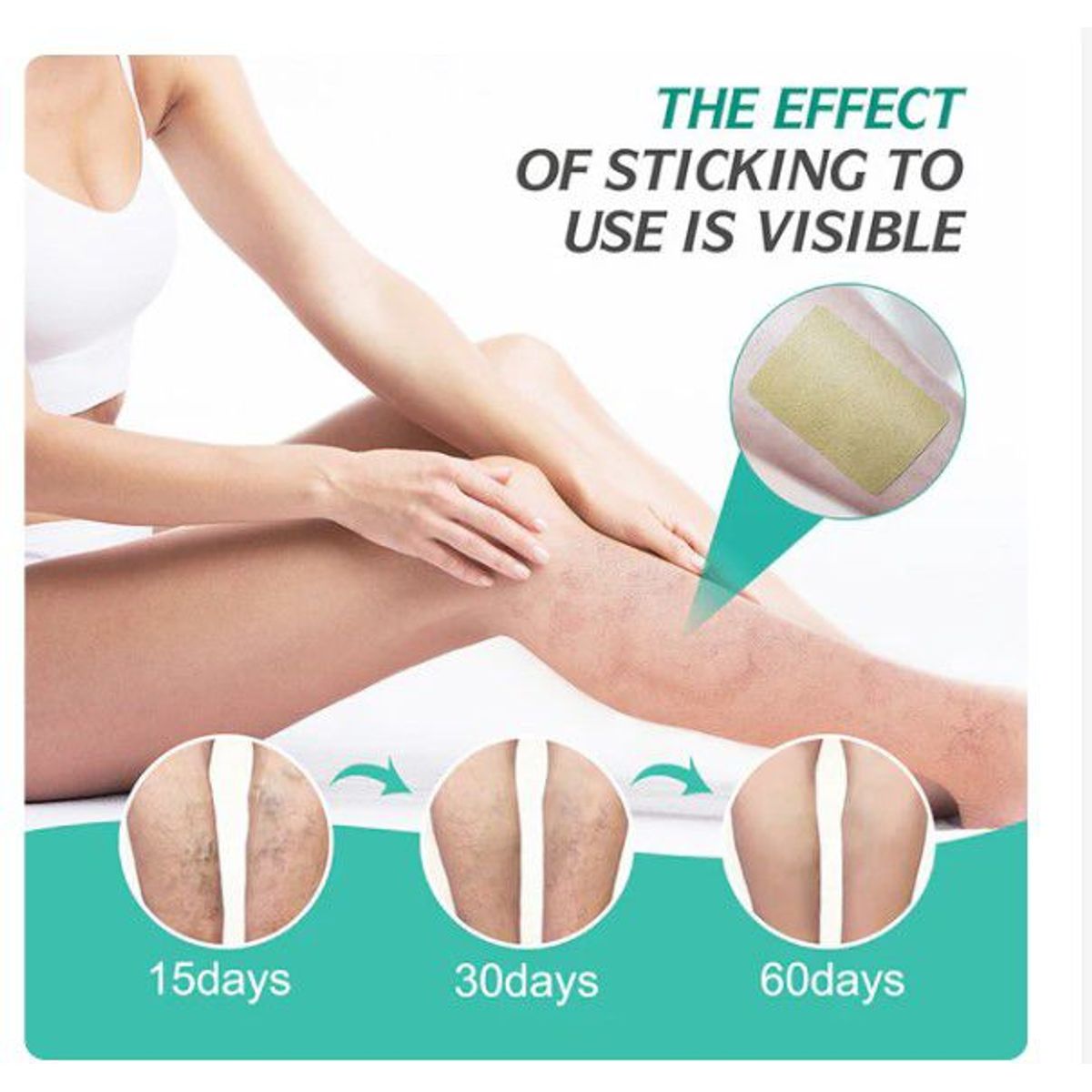 GENERICO - parche de tratamiento de varices