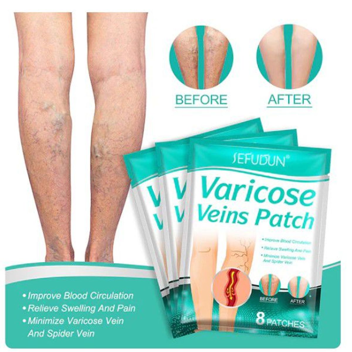 GENERICO - parche de tratamiento de varices