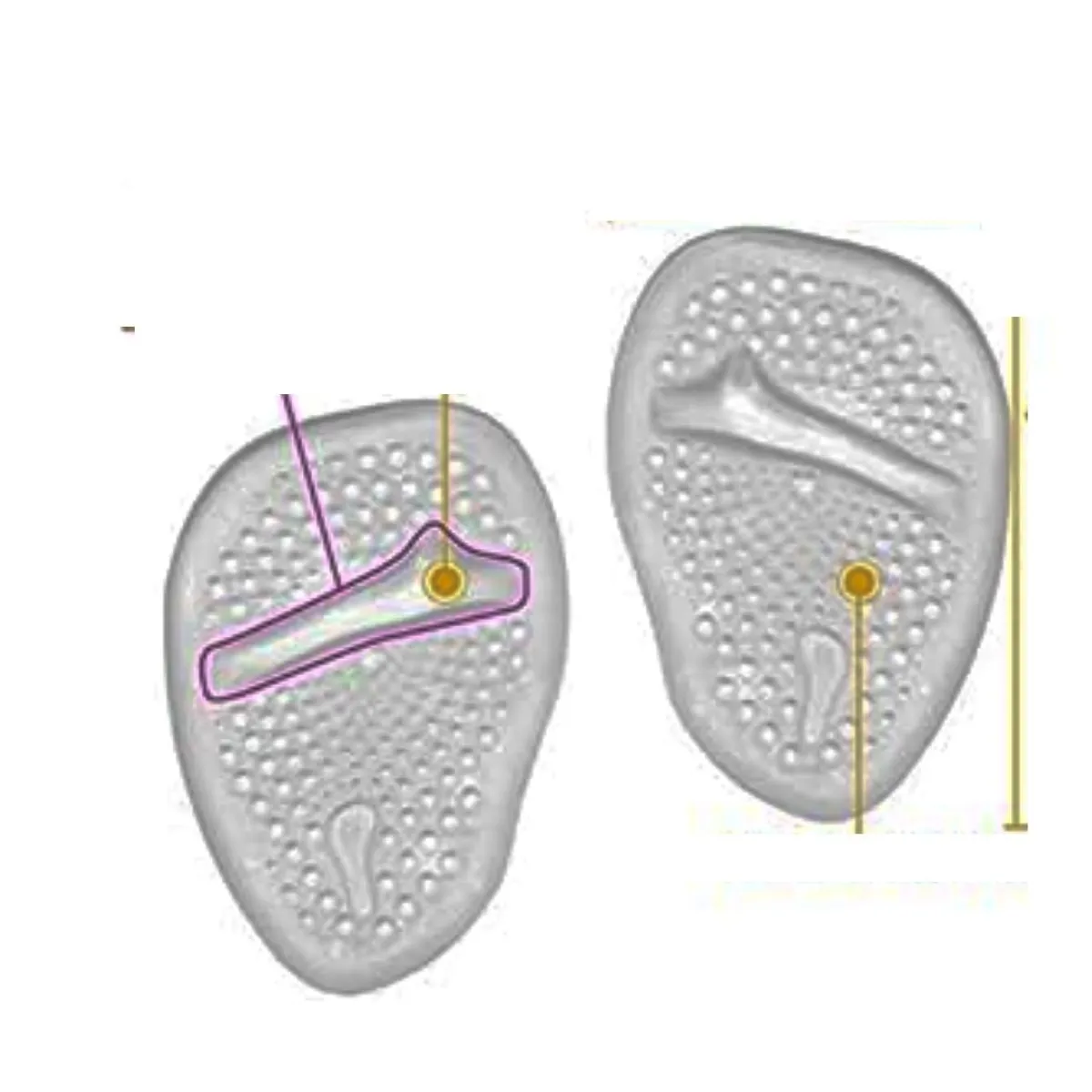 GENERICO - Almohadillas Transparentes para Aliviar Dolor de Tacos