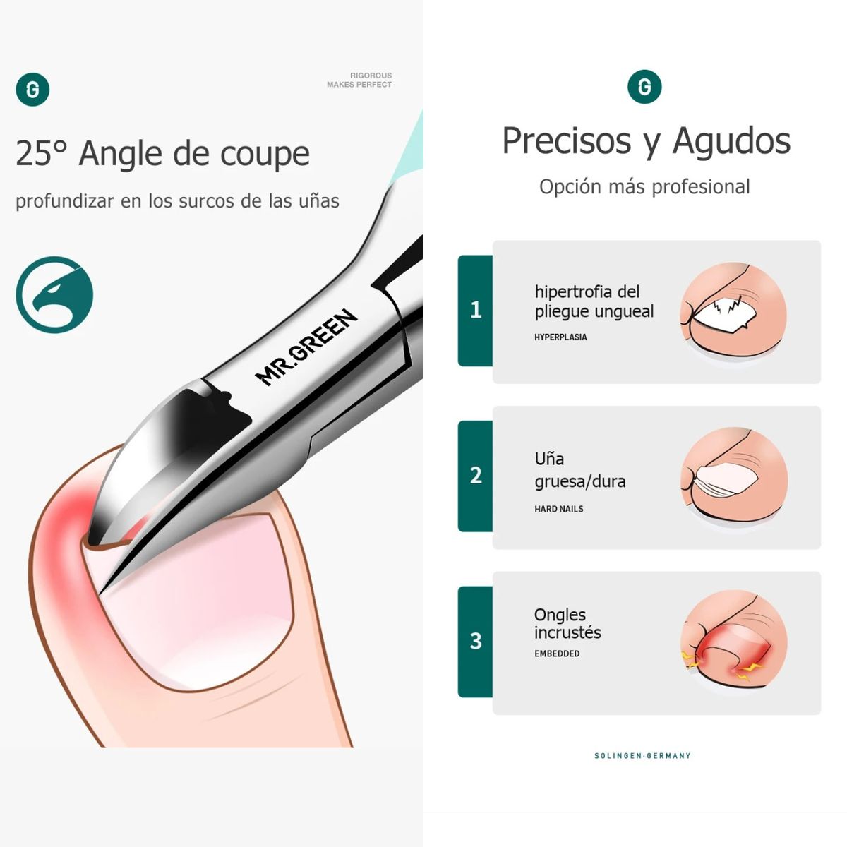 GENERICO - Cortauñas Profesional Pedicura Uñas Encarnadas