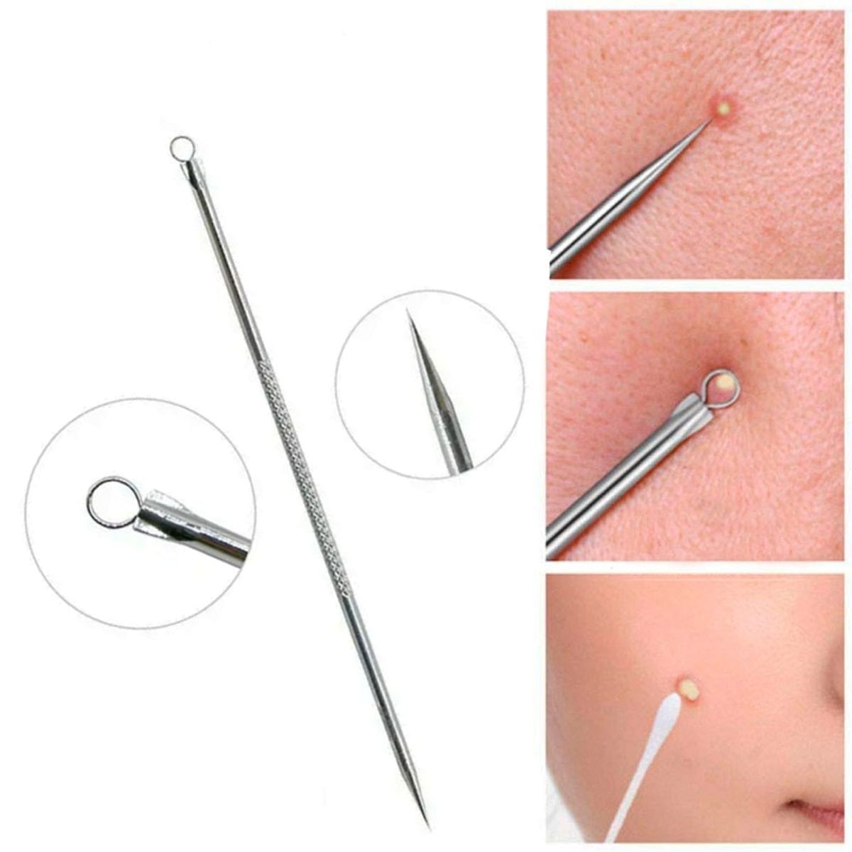 GENERICO - Removedor De Espinillas 3 Unidadesss