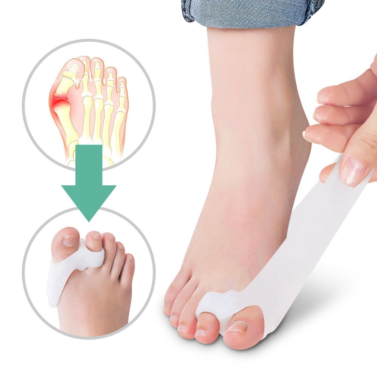 OEM - Juanetes Corrector Hallux Valgus Silicona Dos Dedos - Par