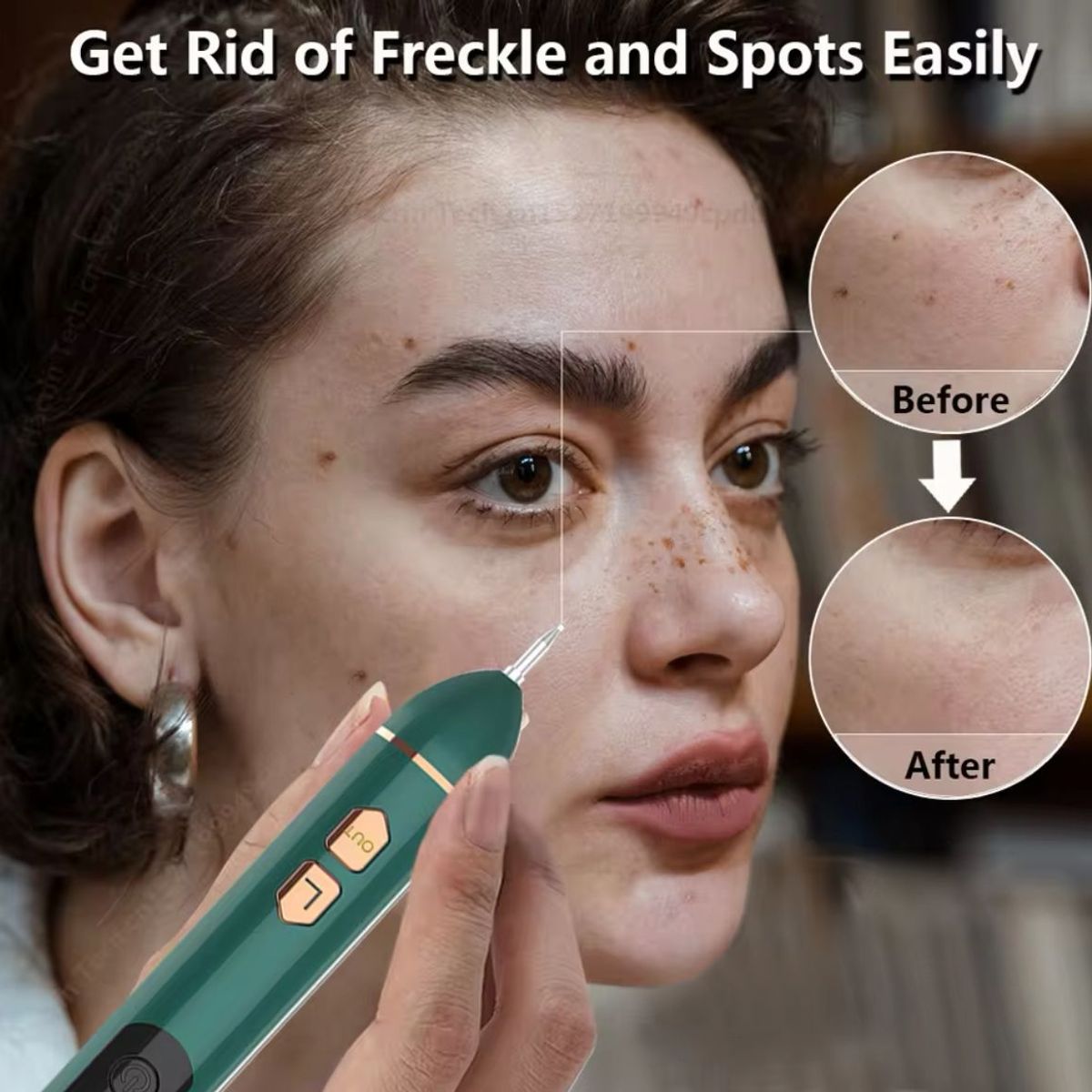 GENERICO - PLUMA LASER DE PLASMA  ELIMINA VERRUGAS COLOR VERDE_.