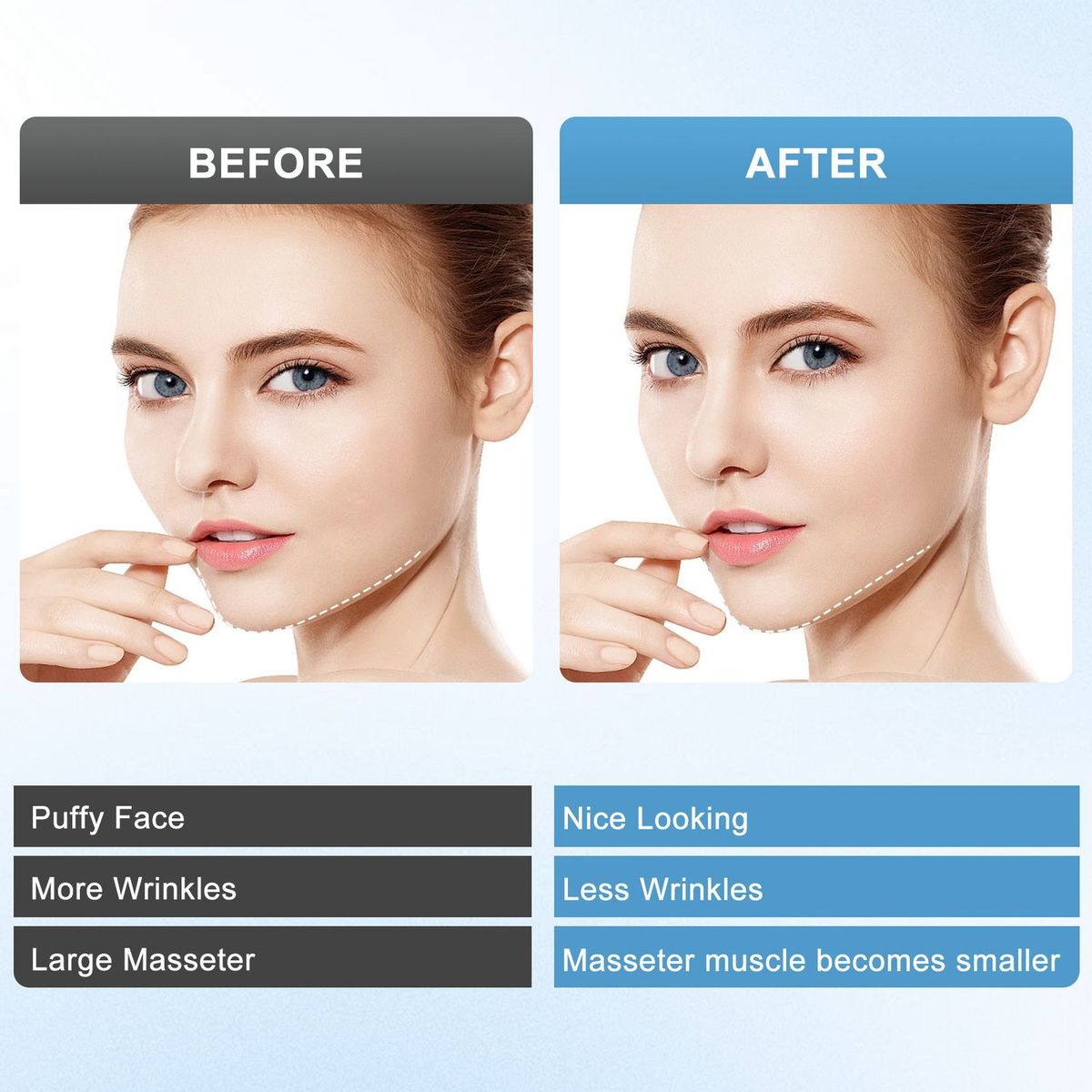 TIOZONEY - Dispositivo de adelgazamiento facial por vibración de microcorriente