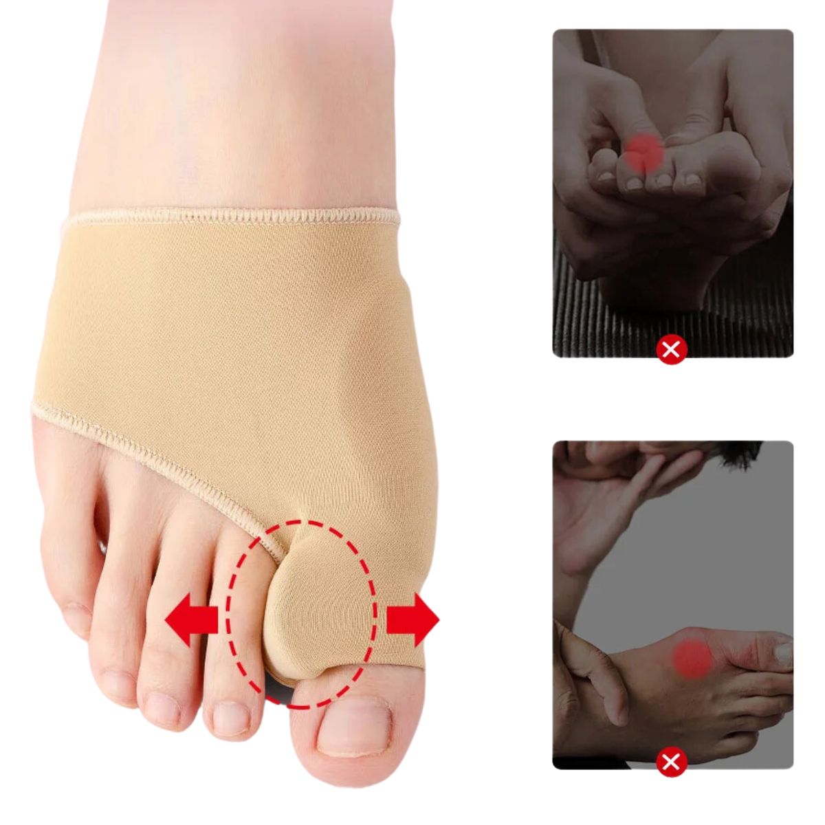 GENERICO - Par de Corrector De Juanetes Para Pies