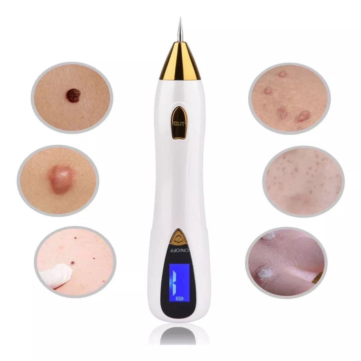 GENERICO - plasma pen Cauterizador Mole Pen