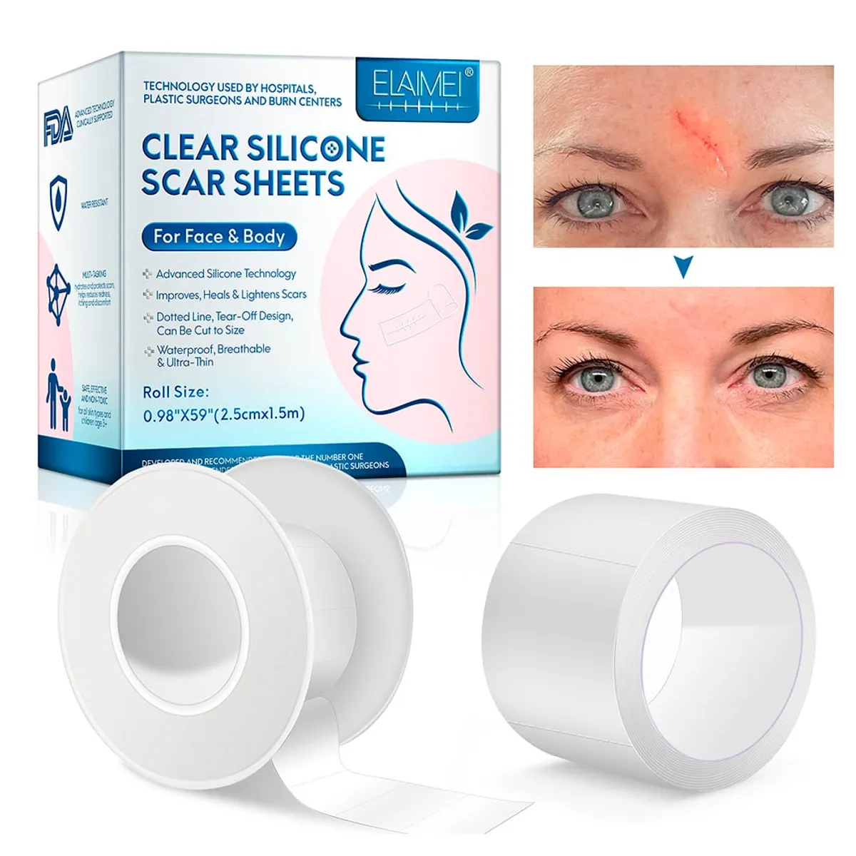 GENERICO - Parches Gel De Silicona Médica Reusables Cicatrices Cirugia ELAIMEI