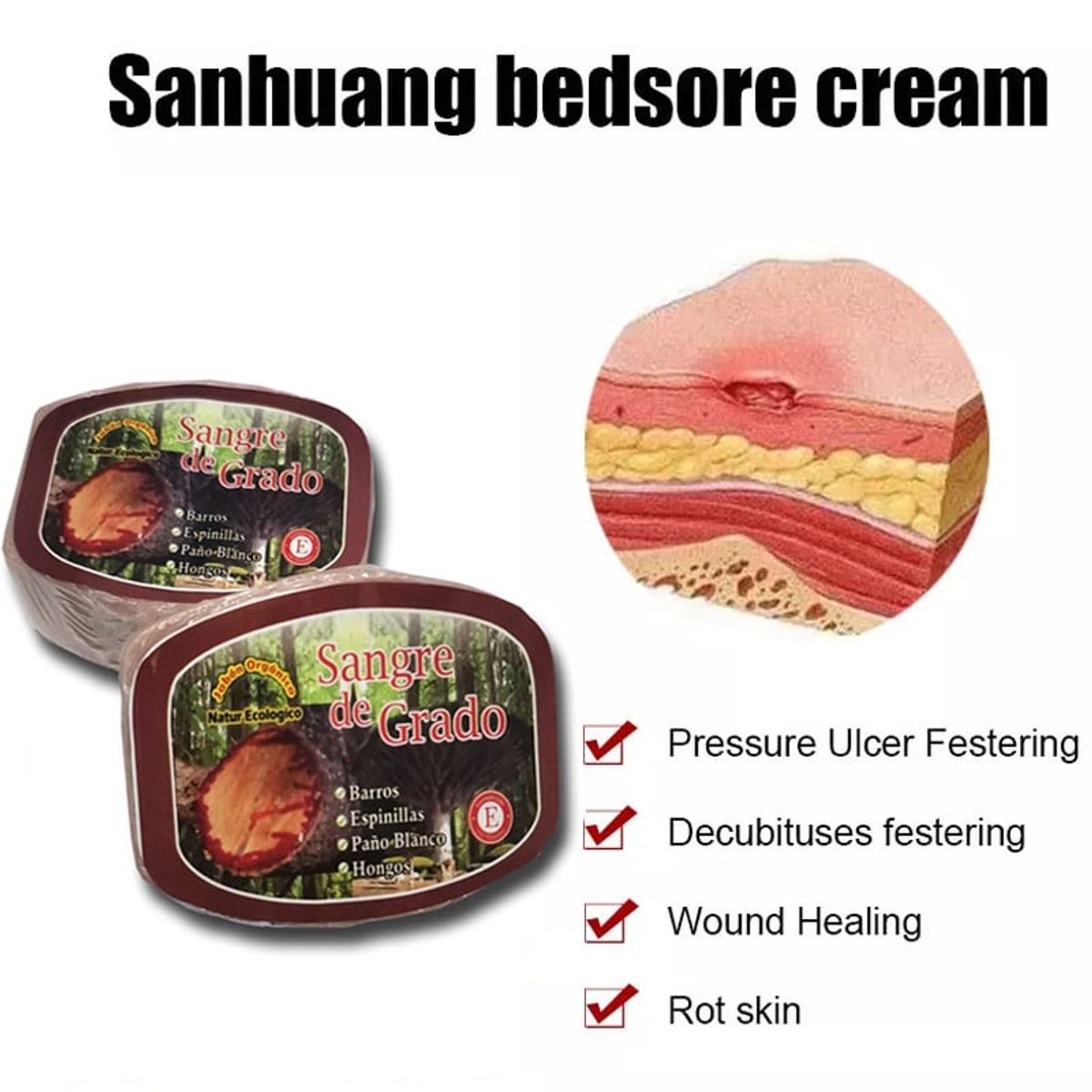 GENERICO - PATCH anti acné  200 unidades y jabon de sangre de grado