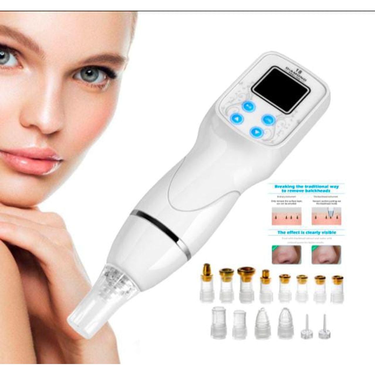 GENERICO - Microdermoabrasion Portátil Punta De Diamantes Kit Repuestos