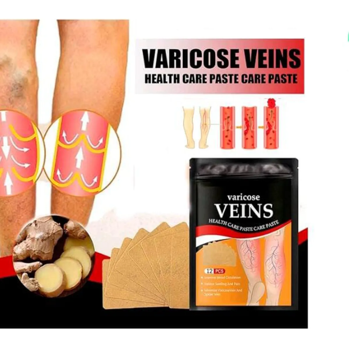 GENERICO - 2 PACK DE PARCHES PARA CIRCULACION VARICES