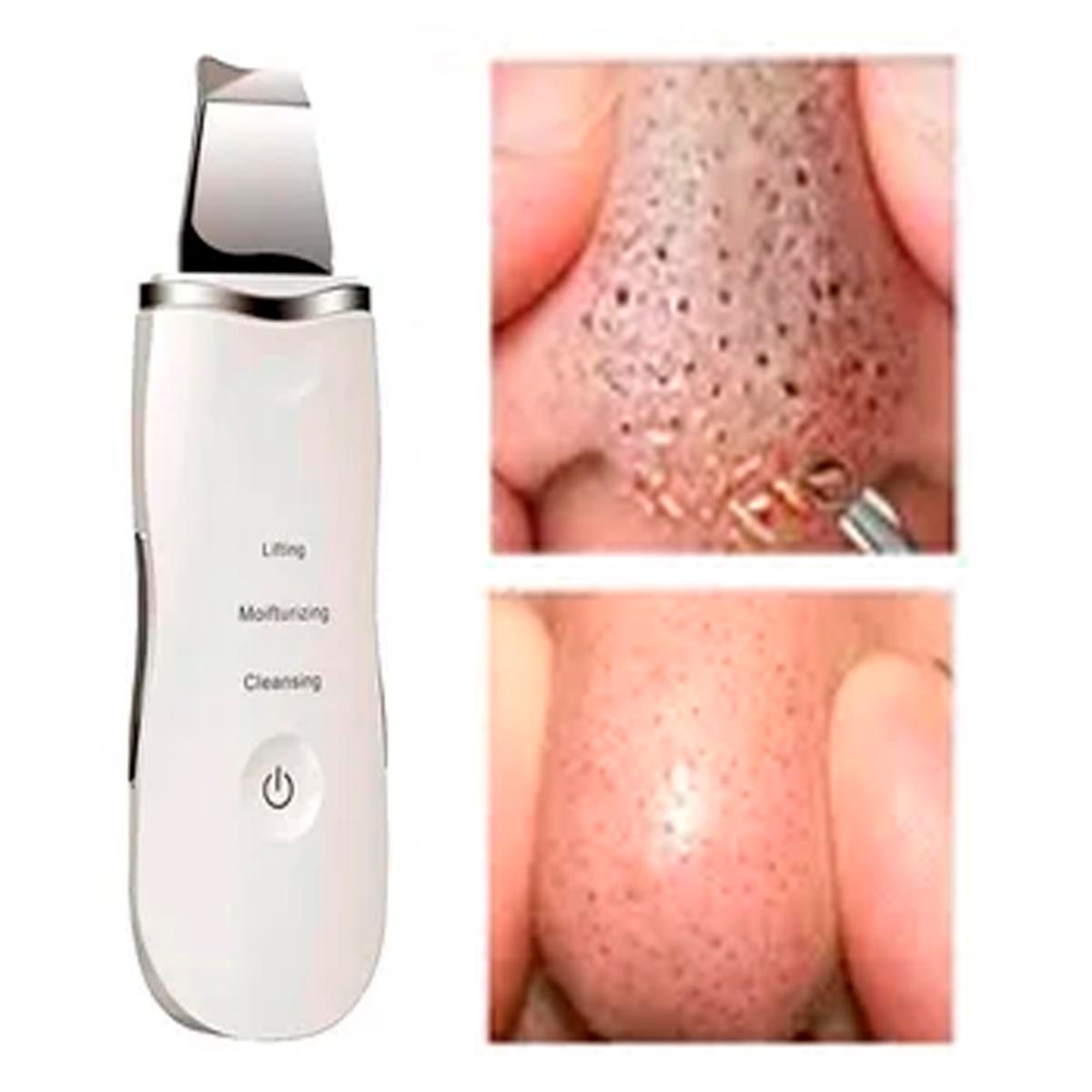 GENERICO - Limpiador Ultrasónico Facial Espátula Lifting Limpieza Profunda