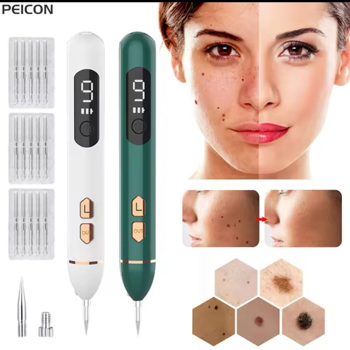 GENERICO - PLUMA LASER DE PLASMA  ELIMINA VERRUGAS COLOR BLANCO_.