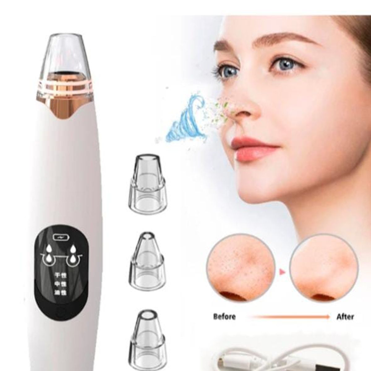 GENERICO - aspiradora eléctrica de poros eliminador de espinillas