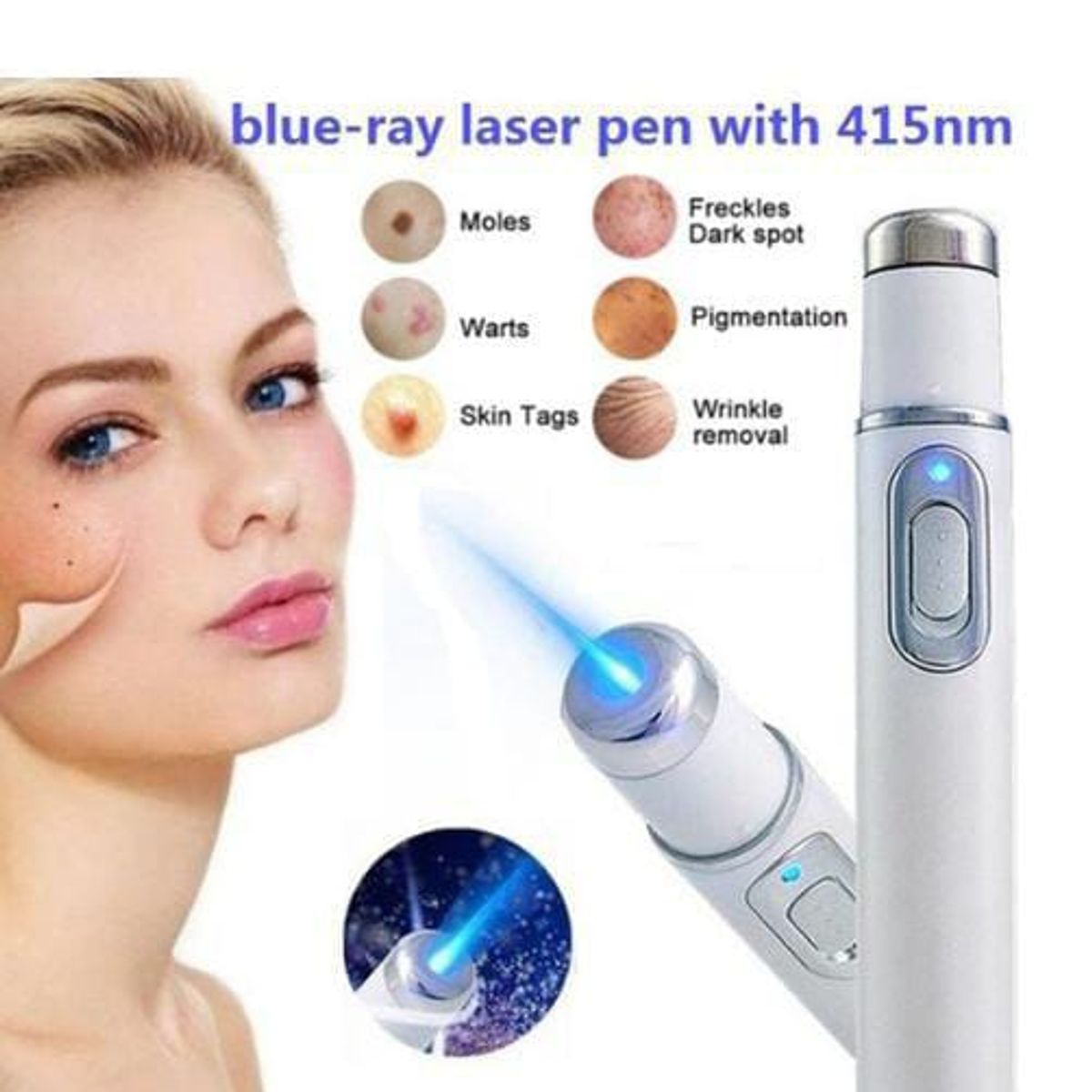 GENERICO - Pluma Láser Portátil Para Eliminar Las Arrugas Acne