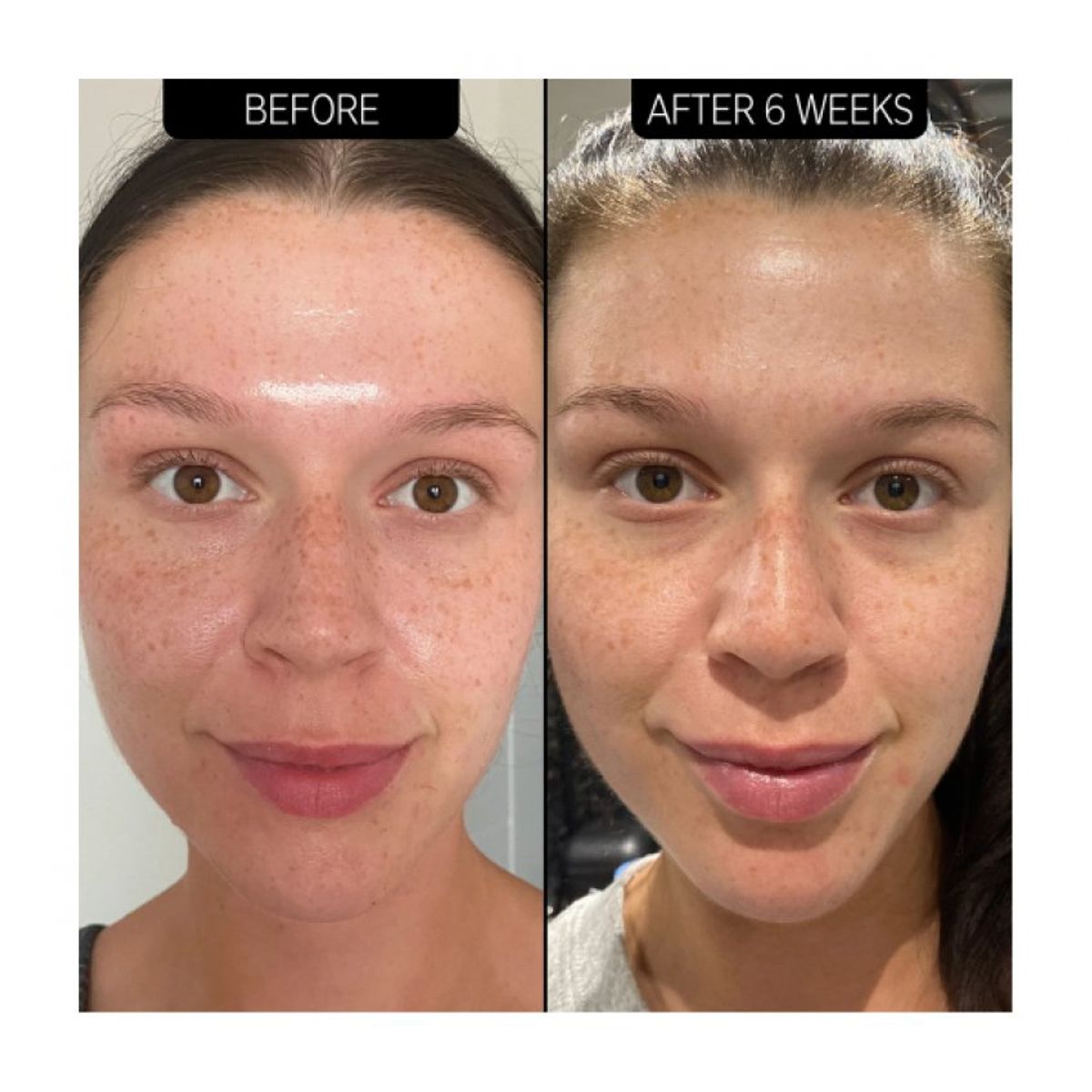 THE INKEY LIST - Serum Facial 30 ml - The INKEY List_123