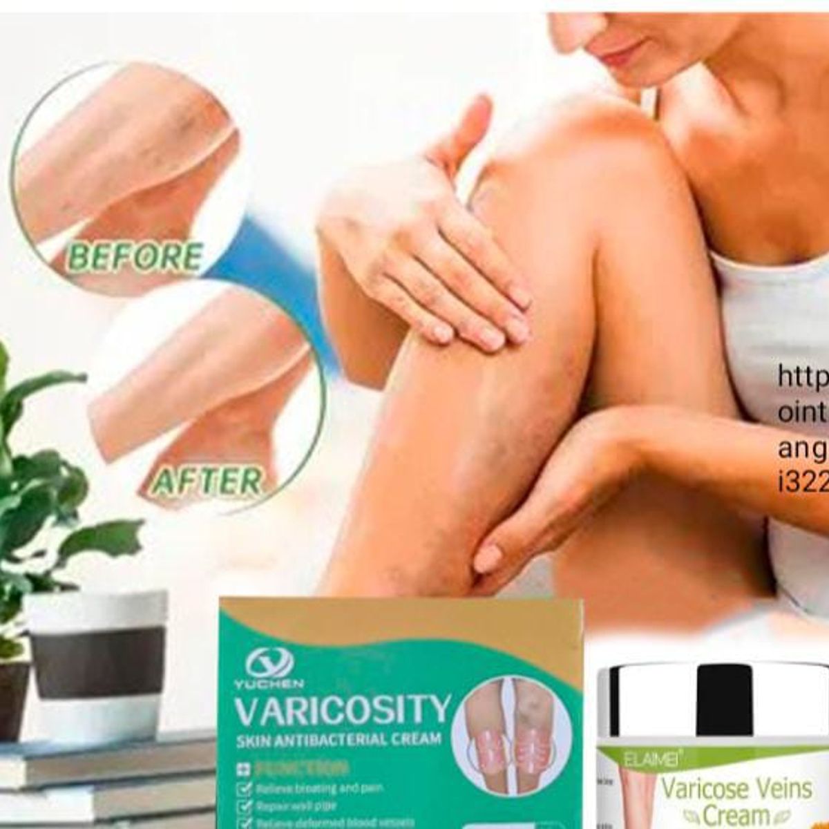 GENERICO - Crema de trtamiento de varices 50gr