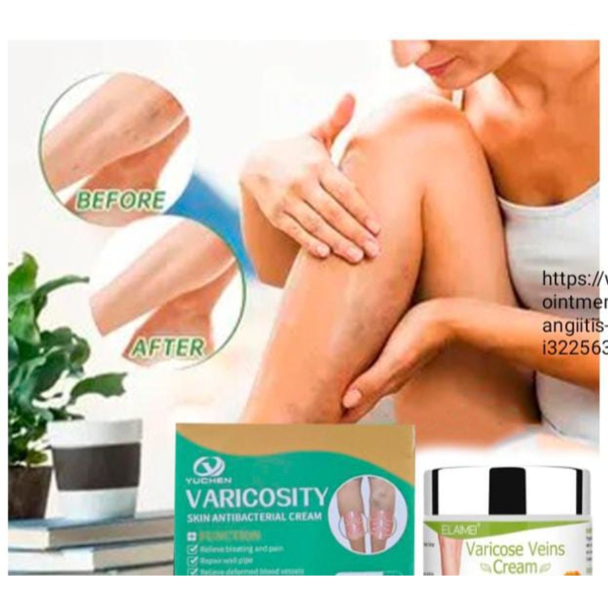 GENERICO - Crema de trtamiento de varices 50gr