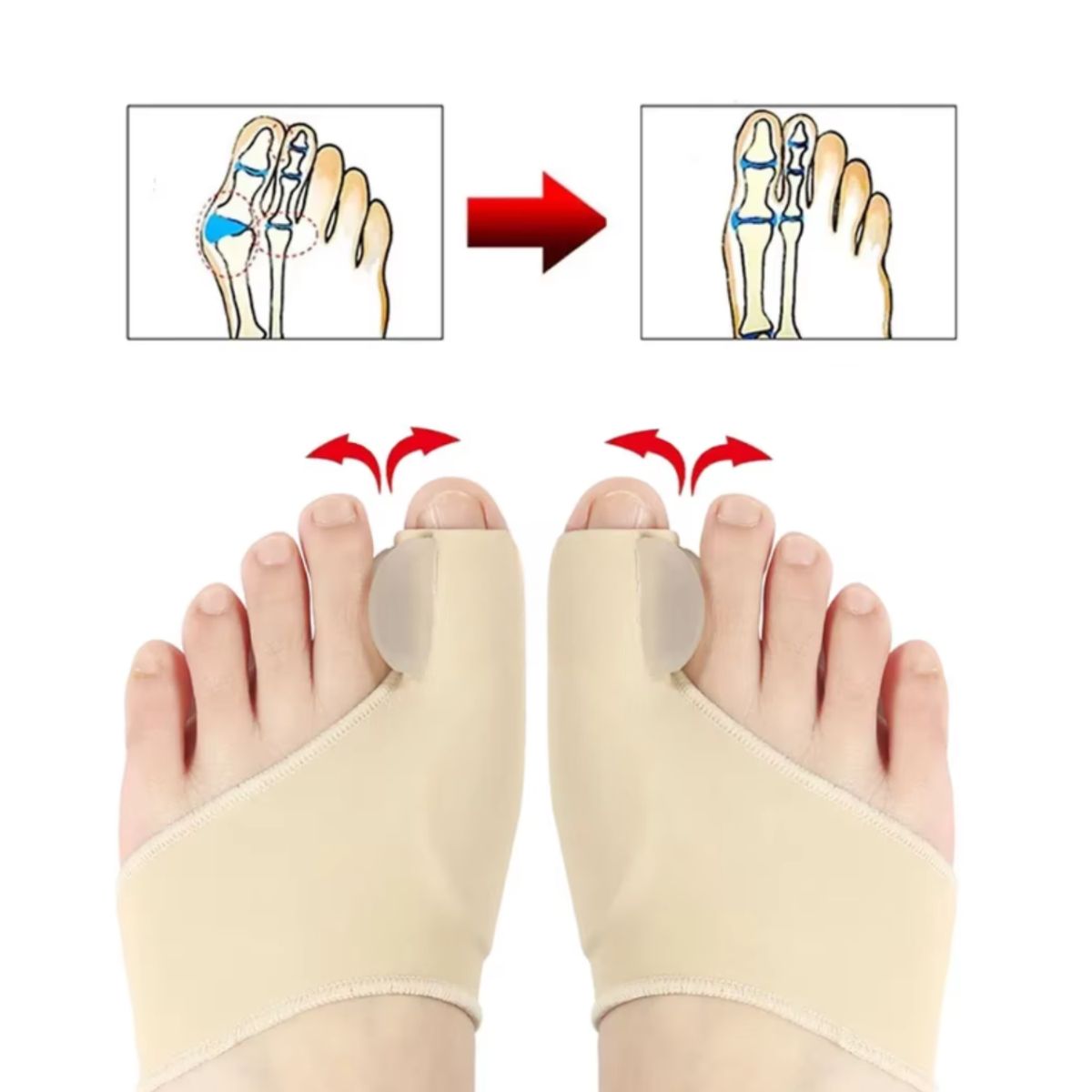 ROHS - Corrector De Juanete Para Dedos De Los Pies