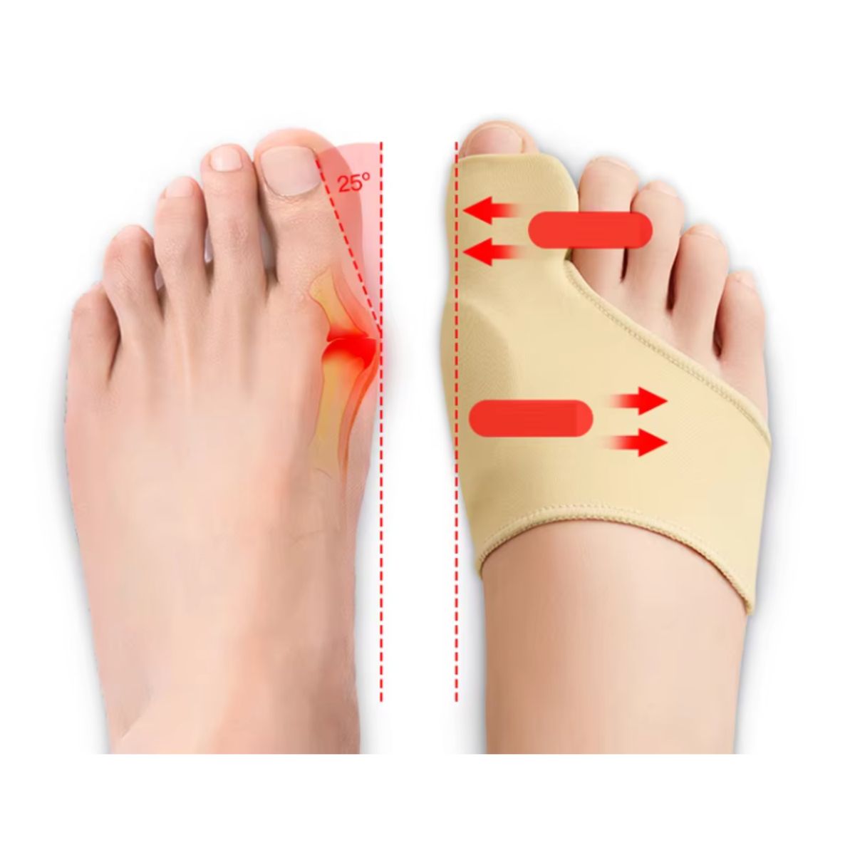 ROHS - Corrector De Juanete Para Aliviar El Dolor De Los Dedos De Los Pies