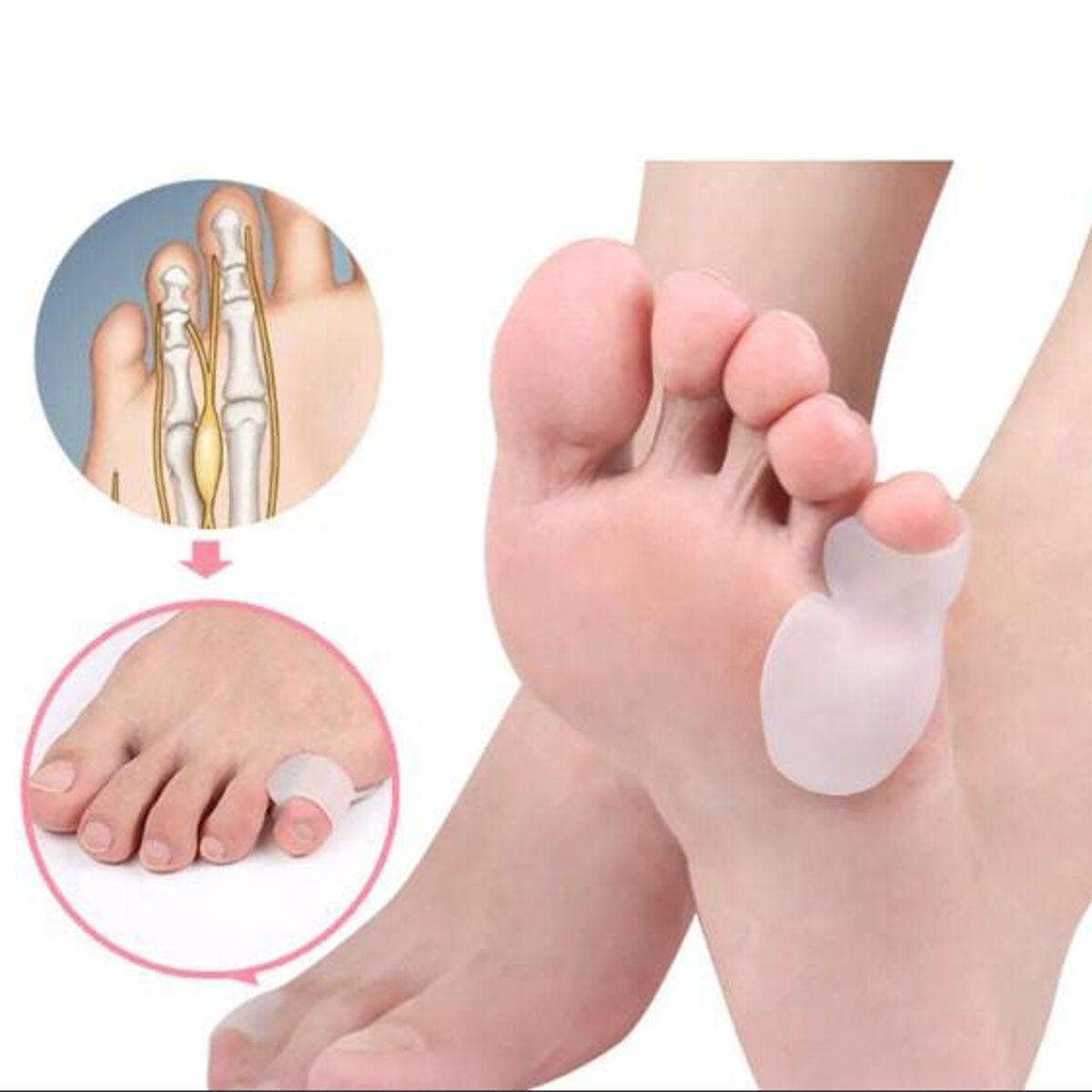 GENERICO - Corrector ortopédico de silicona para el cuidado de los pies