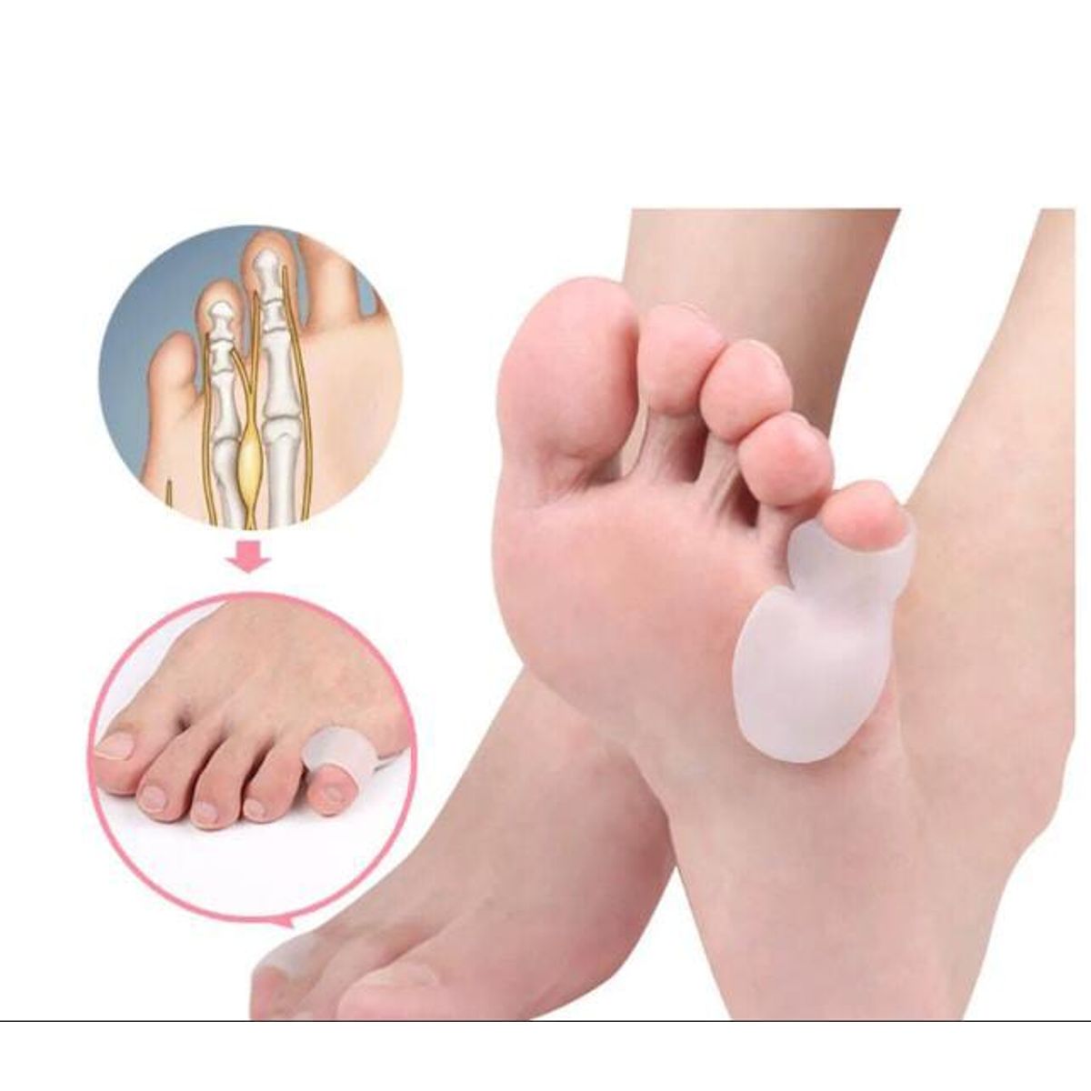 GENERICO - Corrector ortopédico de silicona para el cuidado de los pies