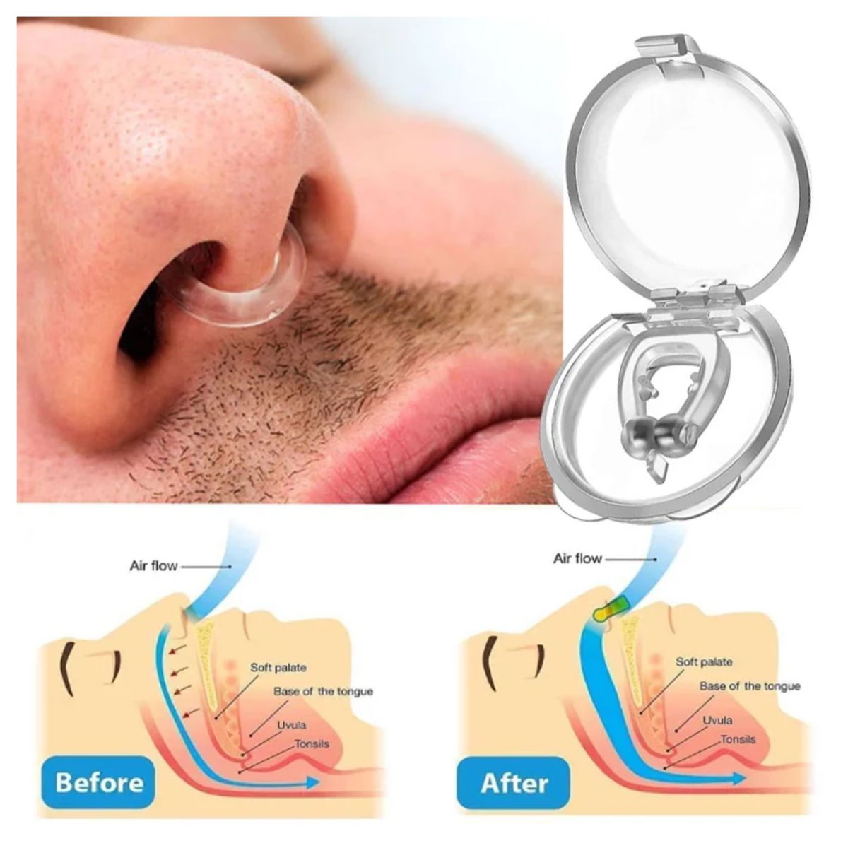ROHS - Clip nasal Antirronquidos para dejar de Roncar x 2 unidades