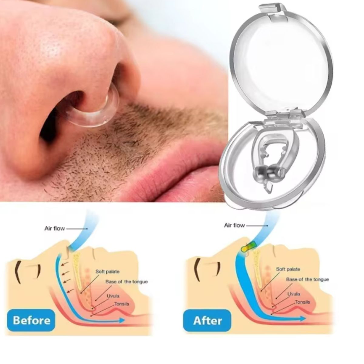 OEM - 4 Clip Antirronquidos Ayuda a Dejar De Roncar