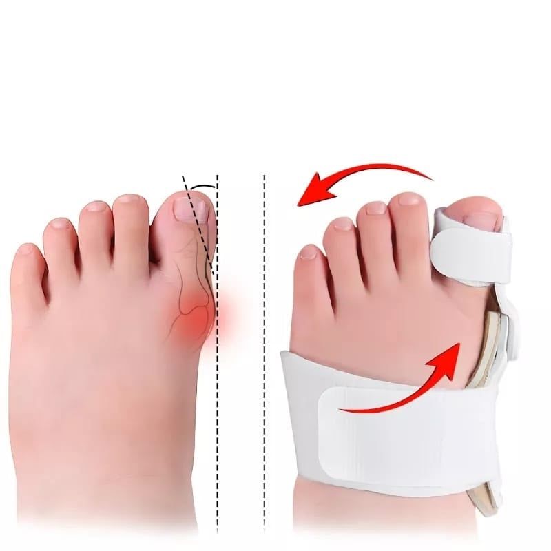 GENERICO - Corrector de Juanete Niño PAR