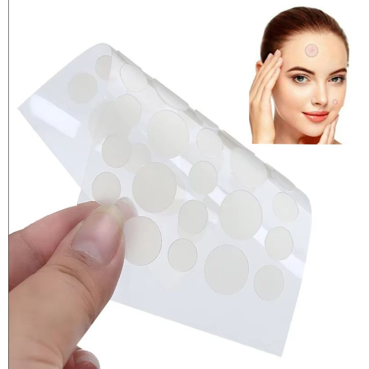 GENERICO - ACNE PLASTERS anti acné y espinilla 30 und