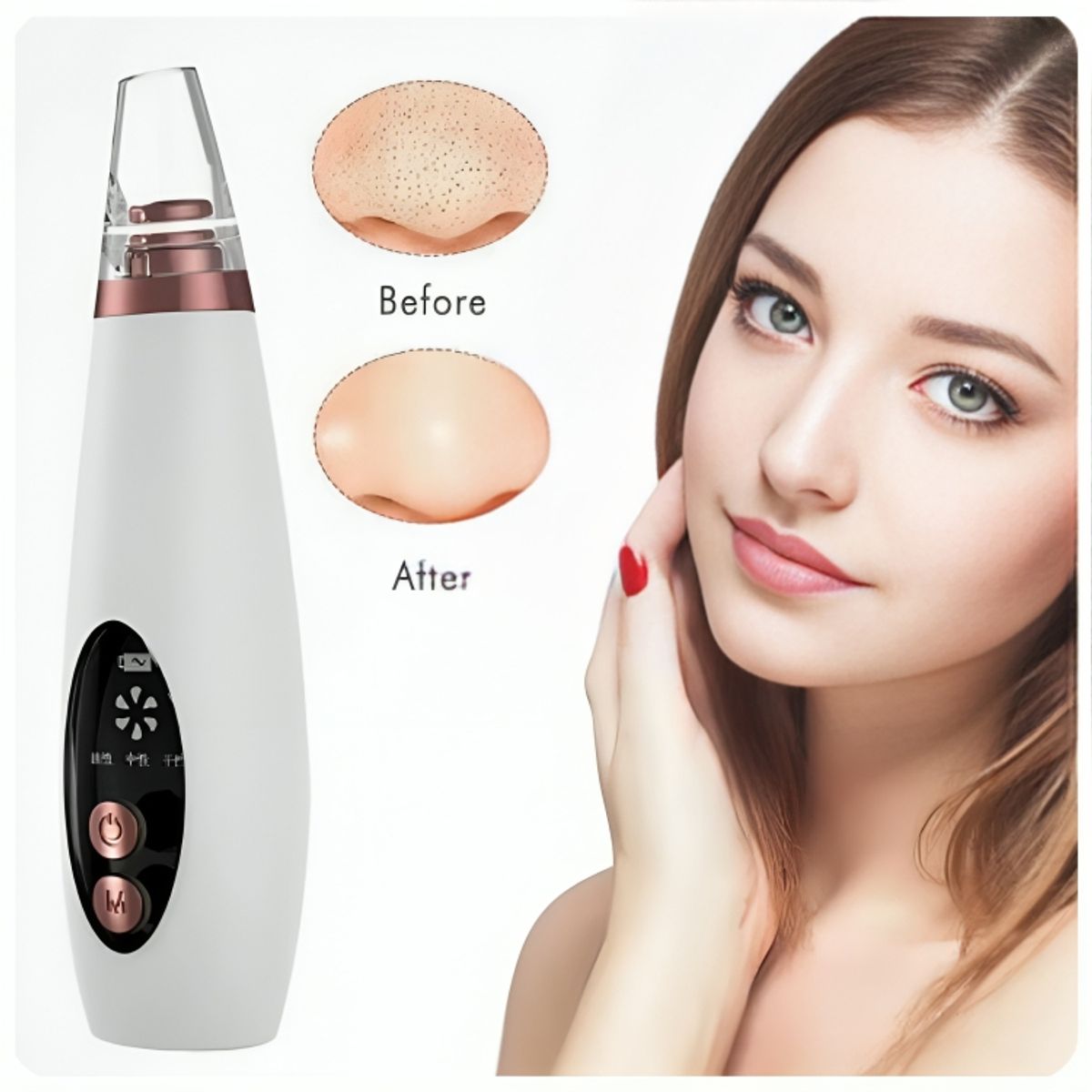 GENERICO - Máquina Limpiador Facial 6 en 1 Removedor Eléctrico de Espinillas Acné