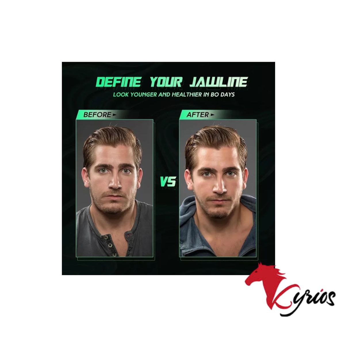 NO LOGO - Ejercitador De Mandíbula - Rojo