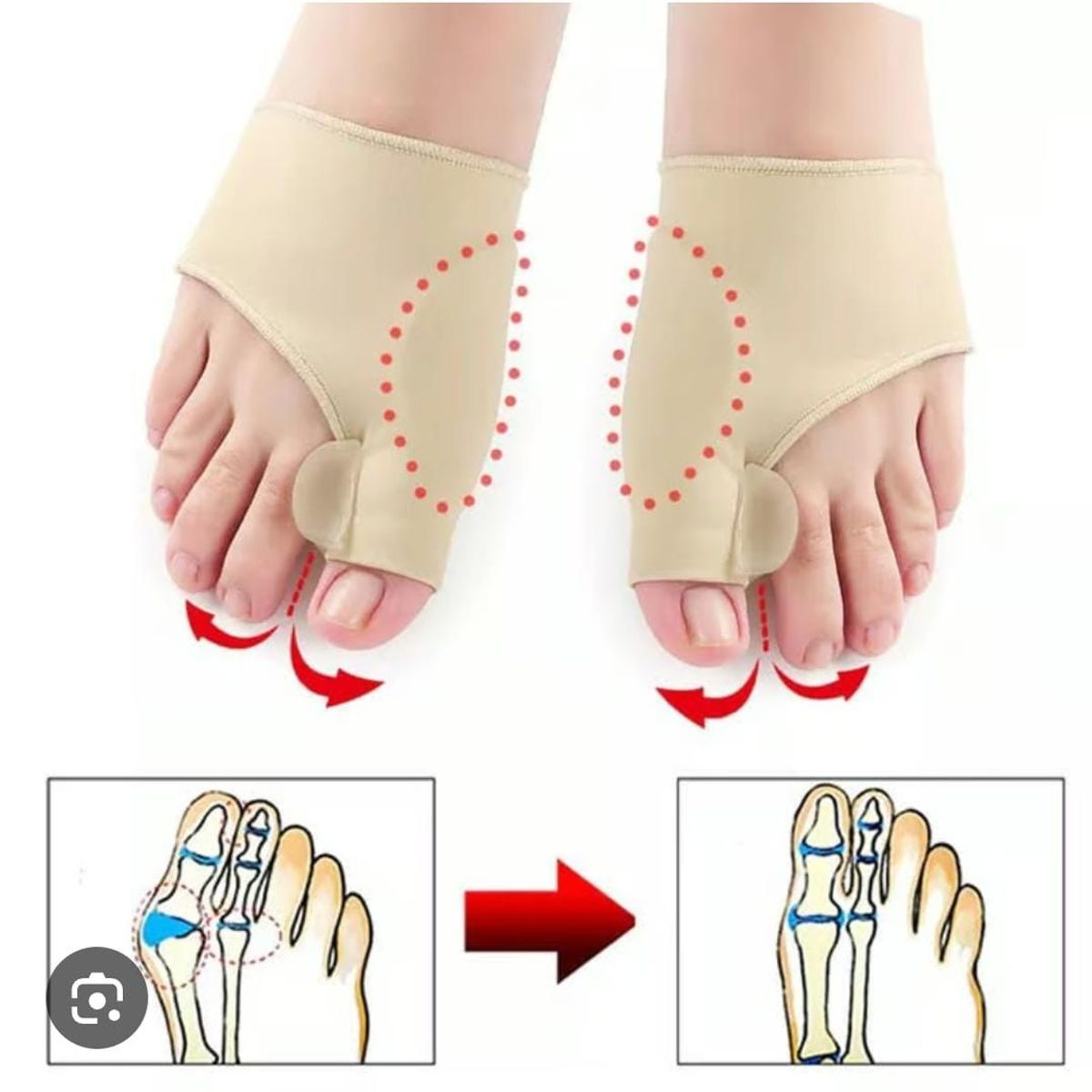 GENERICO - CORRECTOR DE JUANETES