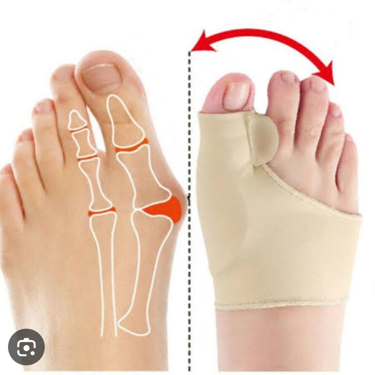 GENERICO - CORRECTOR DE JUANETES