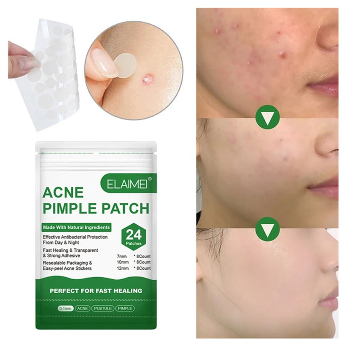 GENERICO - Parches ELAIMEI Hidrocoloide Para Acné, Espinillas de 24 Unids.