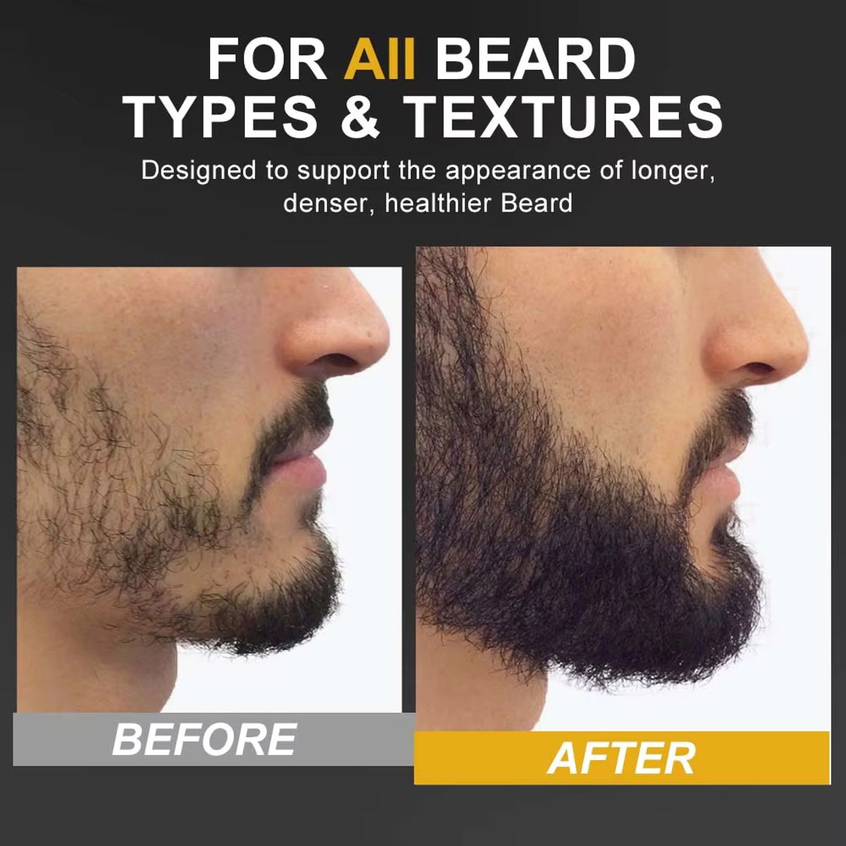 GENERICO - Serum Aceite Crece Barba Y Vello