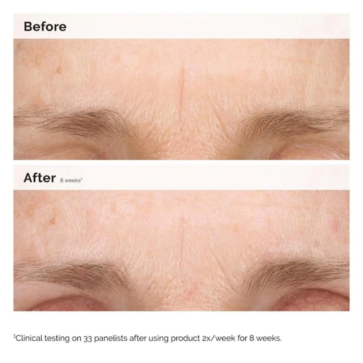 THE ORDINARY - Serum The Ordinary Retinal 0.2% Emulsion 15ml